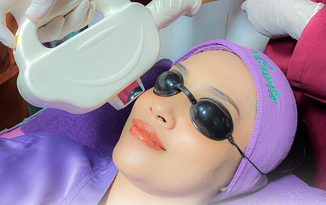 Pasien menjalani perawatan IPL laser oleh tenaga medis di Beauty Medika, klinik kecantikan Malang